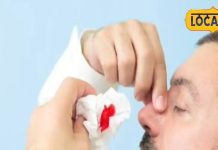 नकसीर होने से नाक से बहता हो खून… तो इन घरेलू उपायों से तुरंत मिलेगी राहत, जानें आयुर्वेदाचार्य की सलाह