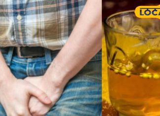 frequent-urination-during-day-due-to-major-underlying-cause-know reasons-and-solution, दिन में कई बार हो रही है पेशाब, हो सकता है यह बड़ा कारण, जानिए क्या है वजह और समाधान