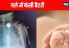 5 महीने के बच्चे की फूड पाइप में फंसी बैटरी, गले में फैला अल्सर, बाल-बाल बची जान