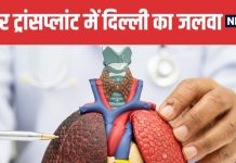 Delhi Leads India Global Rise in Live Donor Liver Transplantation | लाइव डोनर लिवर ट्रांसप्लांट में दिल्ली का दबदबा