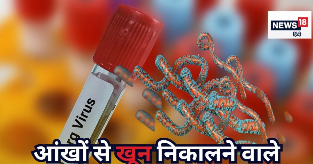 सीधे मौत के मुंह में पहुंचाने वाला मारबर्ग वायरस ने फिर दी दस्तक, इथोपिया में 3 की मौत, क्या भारत में भी है इसका खतरा, जानिए