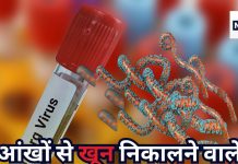 सीधे मौत के मुंह में पहुंचाने वाला मारबर्ग वायरस ने फिर दी दस्तक, इथोपिया में 3 की मौत, क्या भारत में भी है इसका खतरा, जानिए