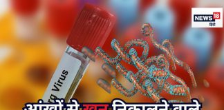 सीधे मौत के मुंह में पहुंचाने वाला मारबर्ग वायरस ने फिर दी दस्तक, इथोपिया में 3 की मौत, क्या भारत में भी है इसका खतरा, जानिए