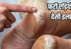 Home Remedy for cracked heels: फटी एड़ियों के लिए 5 रुपये वाला देसी इलाज, ट्राई करें