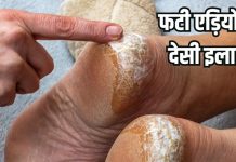 Home Remedy for cracked heels: फटी एड़ियों के लिए 5 रुपये वाला देसी इलाज, ट्राई करें