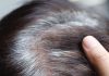 How to stop grey hair problem: बाल सफेद क्यों होते हैं, इन्हें वाइट होने से कैसे बचाएं?