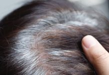 How to stop grey hair problem: बाल सफेद क्यों होते हैं, इन्हें वाइट होने से कैसे बचाएं?