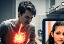 एसिडिटी में क्या खाएं? एक्सपर्ट की बताई इन 5 चीजों में किसी 1 कर लें सेवन, मिनटों में पेट हो जाएगा हल्का!