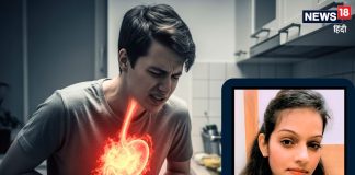 एसिडिटी में क्या खाएं? एक्सपर्ट की बताई इन 5 चीजों में किसी 1 कर लें सेवन, मिनटों में पेट हो जाएगा हल्का!