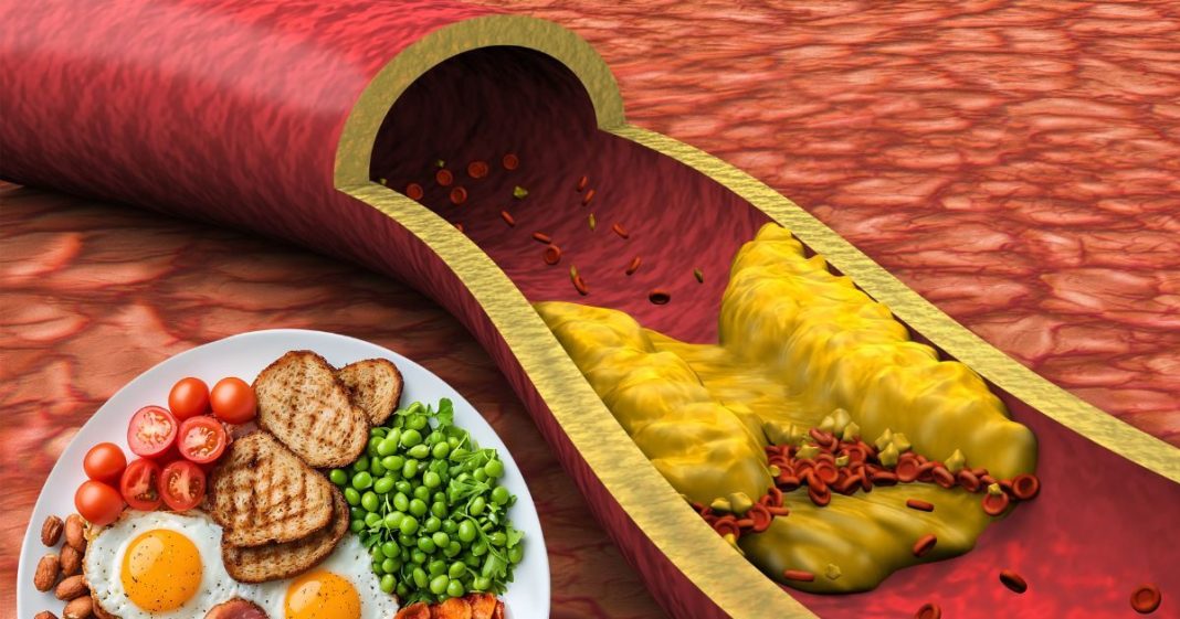 5 Foods reduce cholesterol level | विज्ञान के हिसाब से कैसे कम होगा कोलेस्ट्रॉल