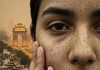how pollution dangerous effects on skin: जहरीली हवा से स्किन को खतरा