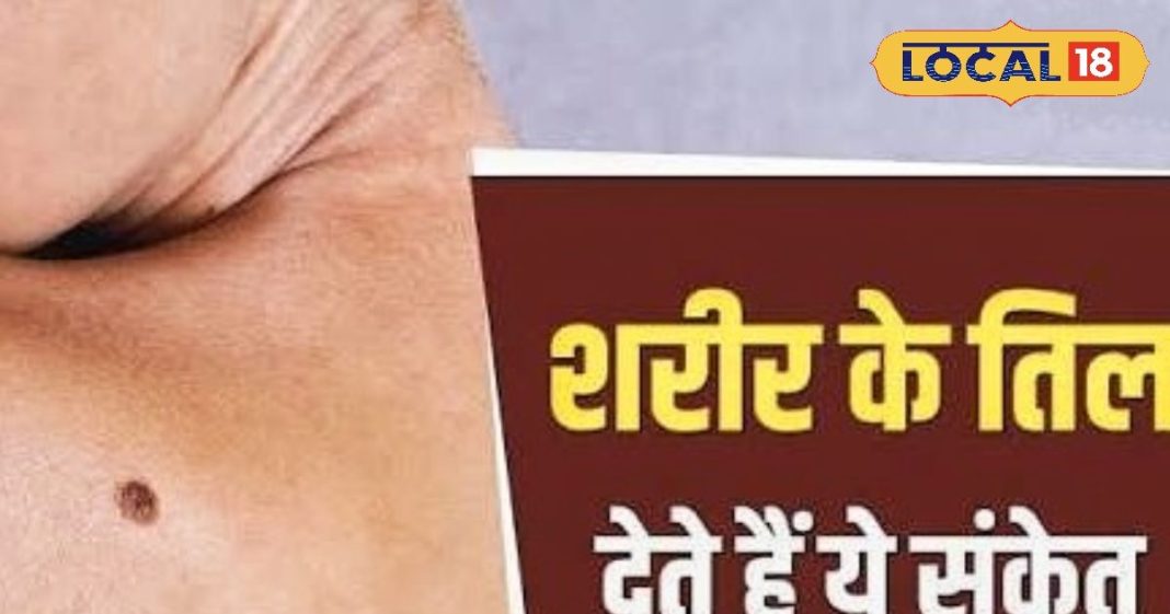 तिल में छुपा है किस्मत का राज, नजरअंदाज करना पड़