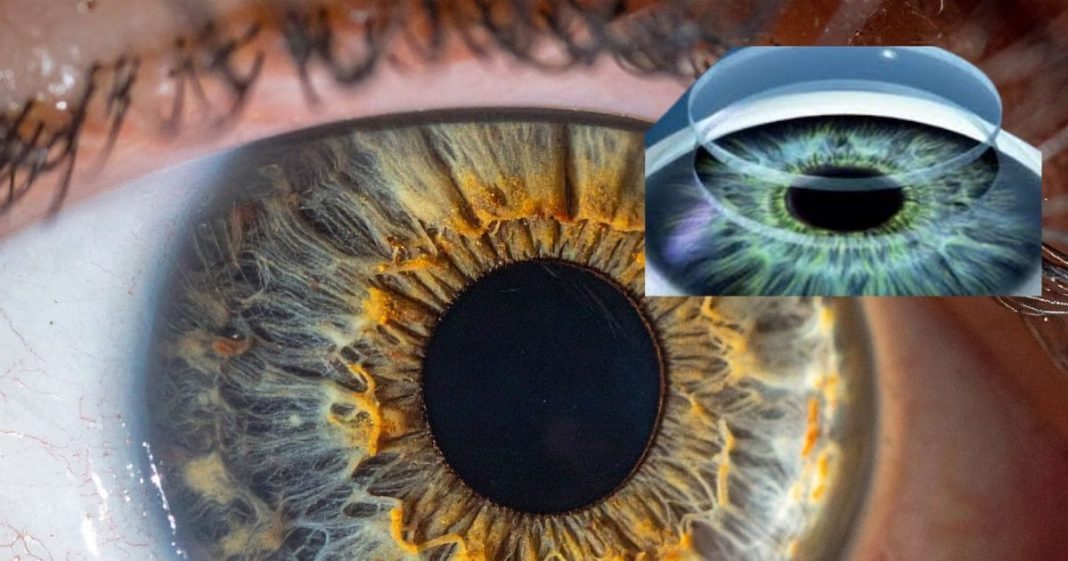 वैज्ञानिकों ने किया करिश्मा, 70 साल के बुजुर्ग में फिट कर दिया दुनिया का पहला 3 D कॉर्निया, अब 1 कॉर्निया से ही बनेंगे सैकड़ों