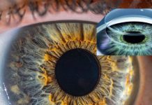 वैज्ञानिकों ने किया करिश्मा, 70 साल के बुजुर्ग में फिट कर दिया दुनिया का पहला 3 D कॉर्निया, अब 1 कॉर्निया से ही बनेंगे सैकड़ों