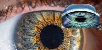 वैज्ञानिकों ने किया करिश्मा, 70 साल के बुजुर्ग में फिट कर दिया दुनिया का पहला 3 D कॉर्निया, अब 1 कॉर्निया से ही बनेंगे सैकड़ों