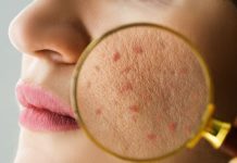 Causes Of Dry Skin| vitamin c deficiency Symptoms| किस विटामिन की कमी से ड्राई होती है स्किन