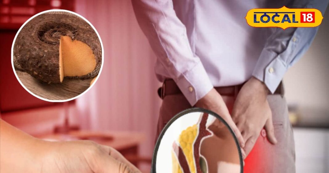 Hemorrhoids Treatment get permanent relief know ayurvedic tips by expert, इस बीमारी को बताने में अगर शरमा रहे, तो आपकी सबसे बड़ी भूल, आयुर्वेद के इस इलाज से होगा खात्मा!