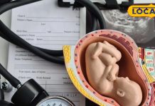 क्या अबॉर्शन कराना लीगल है? क्या है इसकी सही शर्तें और कब कराना होता है सेफ.. जान लीजिए सही जानकारी – Uttar Pradesh News