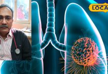 सिगरेट नहीं पी, फिर भी फेफड़े खा गया कैंसर! दिल्ली में सांस लेना मतलब धीमा जहर! ब्यूरोक्रैट की बीमारी से हुआ चौंकाने वाला खुलासा