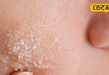 सर्दी में रूखेपन से है परेशान, अपनाएं ये हैं 5 घरेलू नुस्खे मिनटों में लौटाएंगे आपकी चमक