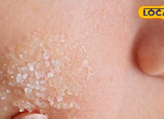 सर्दी में रूखेपन से है परेशान, अपनाएं ये हैं 5 घरेलू नुस्खे मिनटों में लौटाएंगे आपकी चमक