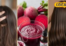 झड़ रहे हैं बाल या पड़ रहे सफेद? चुकंदर आपके लिए सूपरफूड, किसी भी दवा से ज्यादा मारक – Uttar Pradesh News