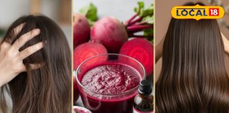 झड़ रहे हैं बाल या पड़ रहे सफेद? चुकंदर आपके लिए सूपरफूड, किसी भी दवा से ज्यादा मारक – Uttar Pradesh News