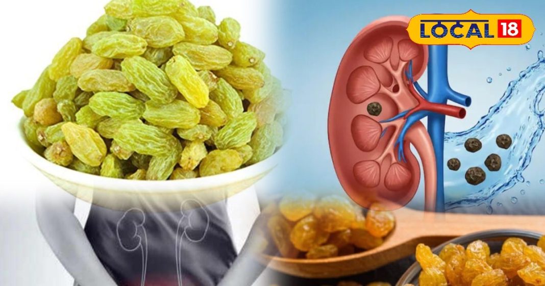 पथरी में कारगर है दादी-नानी का यह घरेलू नुस्खा, पेशाब में जलन से भी दिलाता है राहत, जान लें सेवन का तरीका