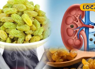 पथरी में कारगर है दादी-नानी का यह घरेलू नुस्खा, पेशाब में जलन से भी दिलाता है राहत, जान लें सेवन का तरीका