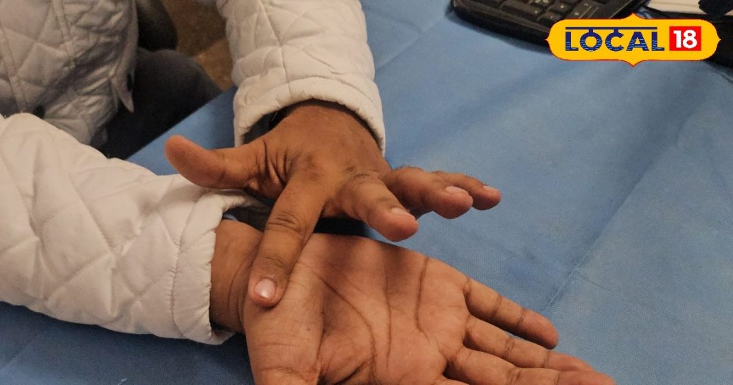 भारी पड़ी मोबाइल की लत, कानपुर में सुन्न हो गए 300 लोगों के हाथ, आप भी तो नहीं इस घातक सिंड्रोम के शिकार? – Uttar Pradesh News