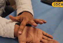 भारी पड़ी मोबाइल की लत, कानपुर में सुन्न हो गए 300 लोगों के हाथ, आप भी तो नहीं इस घातक सिंड्रोम के शिकार? – Uttar Pradesh News