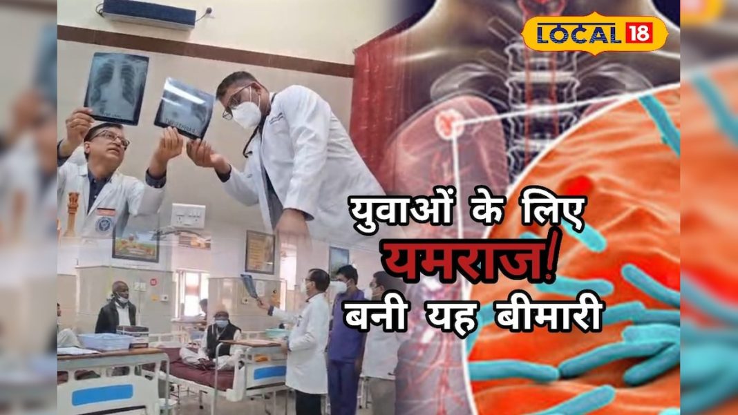 युवाओं के लिए खतरे की घंटी! यमराज बनकर निगल रहा टीबी, इन लक्षणों को न करें नजरअंदाज