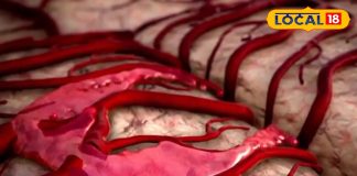 ठंड का मौसम और हार्ट अटैक..भूलकर भी न करें इन लक्षणों को इग्नोर, वरना पड़ेगा सिर्फ पछताना..यहां जानिए आयुर्वेदिक उपचार – Uttar Pradesh News