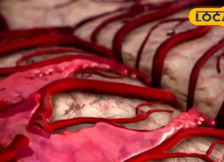 ठंड का मौसम और हार्ट अटैक..भूलकर भी न करें इन लक्षणों को इग्नोर, वरना पड़ेगा सिर्फ पछताना..यहां जानिए आयुर्वेदिक उपचार – Uttar Pradesh News