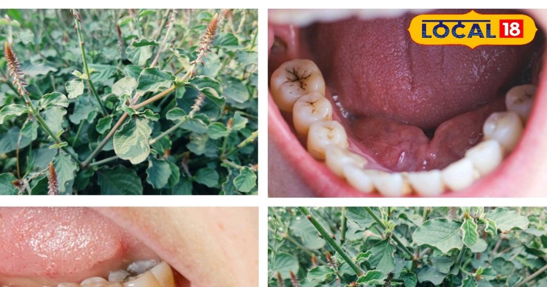 दांत दर्द और इससे जुड़ी समस्याओं को कहें बाय-बाय, जान लें कैसे करना है इस छोटे से चमत्कारी पौधे का इस्तेमाल
