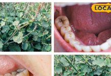 दांत दर्द और इससे जुड़ी समस्याओं को कहें बाय-बाय, जान लें कैसे करना है इस छोटे से चमत्कारी पौधे का इस्तेमाल