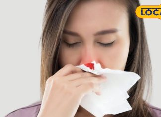 सर्दियों में बढ़ जाता है नाक से ब्लीडिंग का खतरा, ये हैं कारण, स्पेशलिस्ट डॉक्टर ने बताए बचाव के उपाय