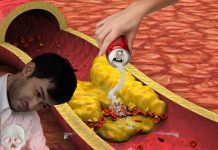 what cause heart disease: हाई कोलेस्ट्रॉल नहीं ये सफेद चीज है दिल की सबसे बड़ी दुश्मन