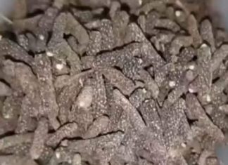 सर्दियों में बीमारियों से बचना है? तो डाइट में शामिल करें पीपली, डॉक्टर से जानिए इसके जबरदस्त फायदे – Uttar Pradesh News