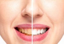 Datun Health Benefits Ayurveda Natural Remedy for Teeth Digestion and Eye Health | दांत पेट और आंखों के लिए प्रकृति का वरदान है दातुन