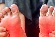 Feet Burning Reason: पैरों में जलन का कारण और आयुर्वेदिक उपाय