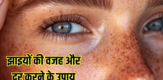 How to reduce facial Freckles: किन विटामिंस की कमी से चेहरे पर होती हैं झाइयां? कैसे करें दूर