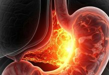 Ayurvedic remedies for digestion| पाचन तंत्र की गड़बड़ी से राहत के लिए आयुर्वेदिक उपाय