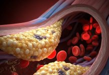 What To Avoid In High Cholesterol: बढ़ा हुआ है कोलेस्ट्रॉल, तो न खाएं ये 3 फूड्स