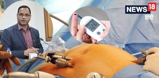 Good news: डायबिटीज का मिल गया पक्का इलाज, एम्स में 30 मरीज हुए ठीक, सर्जरी से खत्म हो रही बीमारी