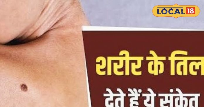 तिल में छुपा है किस्मत का राज, नजरअंदाज करना पड़