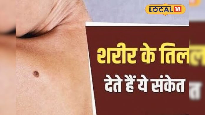 शरीर के इन स्थानों पर तिल माने जाते हैं सबसे
