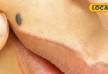 सिर्फ निशान नहीं है तिल, ऊपरी होंठ पर तिल बदल सकता है आपकी किस्मत! जानिए कैसे, देवघर के ज्योतिषाचार्य से?