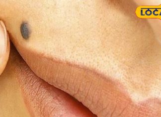 सिर्फ निशान नहीं है तिल, ऊपरी होंठ पर तिल बदल सकता है आपकी किस्मत! जानिए कैसे, देवघर के ज्योतिषाचार्य से?