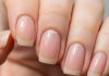 Your Nails Can Reveal A Lot About Your Health: जानें नेल्स से कैसे है सेहत का कनेक्शन